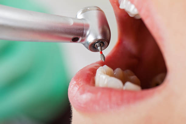 Best Emergency Tooth Extraction in Shark River Hills, NJ